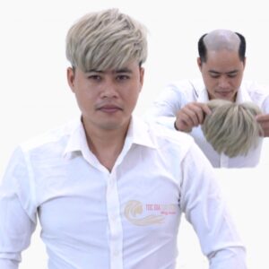 Mái Hói Nam SD - Hình ảnh 14