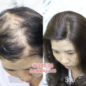 Mái Hói Nữ Siêu Da | Mái Che Phủ Đỉnh - Hình ảnh 3